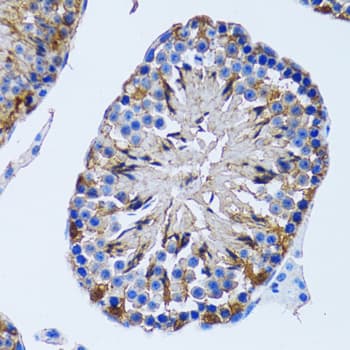 Polyclonal Rabbit anti-Human IMPA1 / IMP Antibody (IHC, IF, WB)