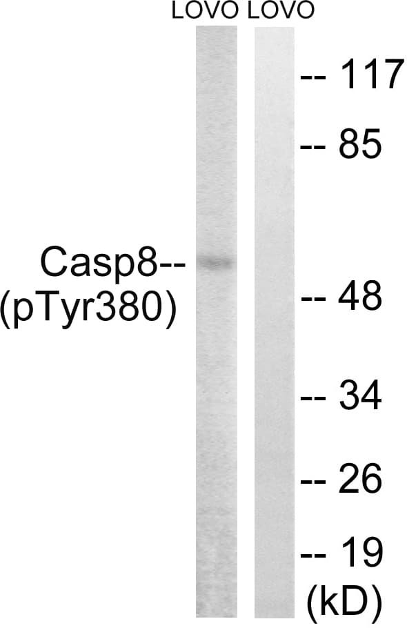 Polyclonal Rabbit anti-Human CASP8 / Caspase 8 Antibody (phospho-Tyr380, WB)