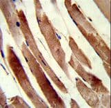 TAGLN / Transgelin / SM22 Antibody (aa24-51)