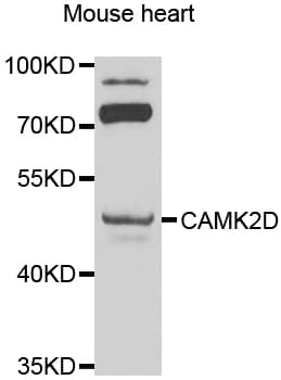 CAMK2D / CaMKII Delta Antibody