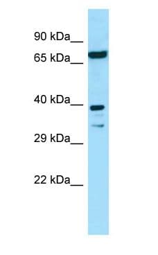 Polyclonal Rabbit anti-Human EIF2B2 Antibody (aa93-142, WB)