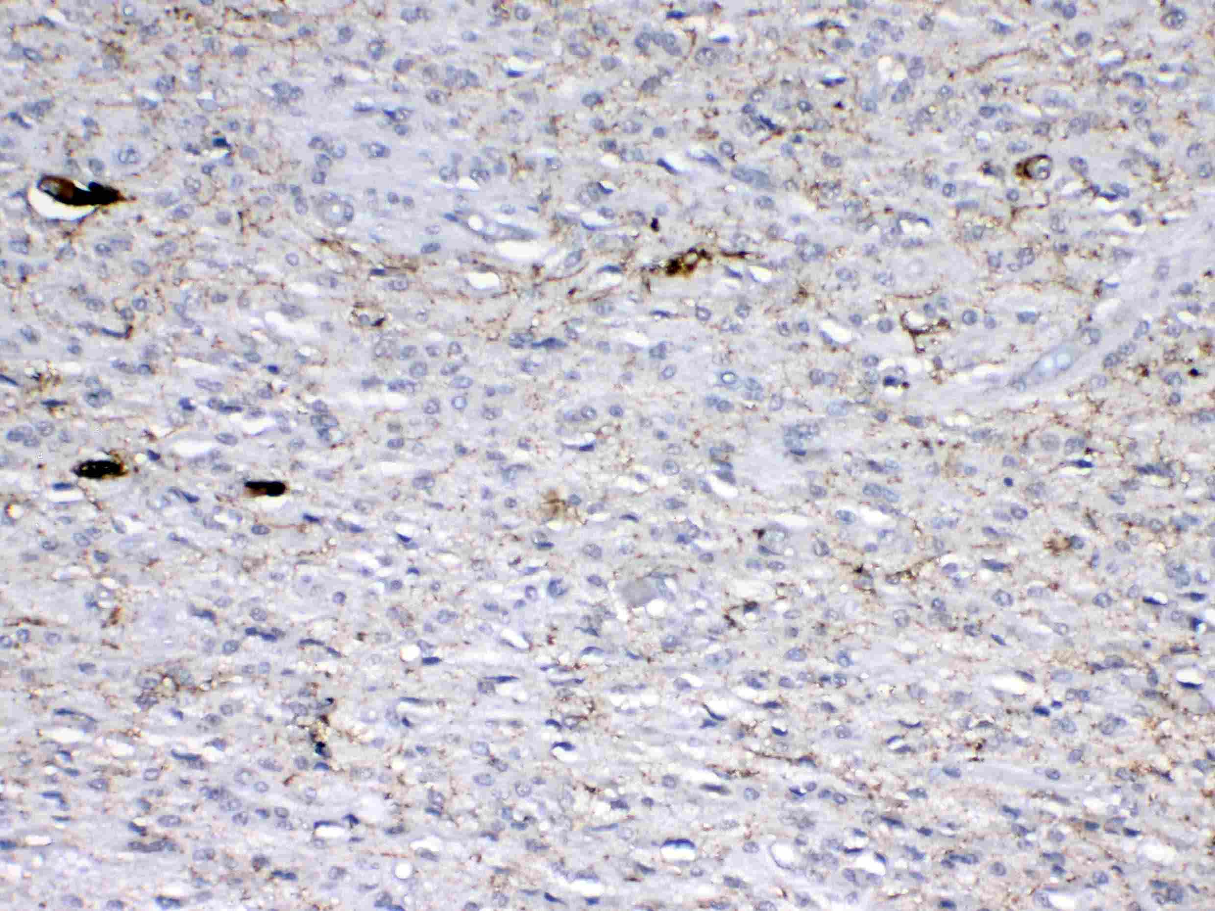 Polyclonal Rabbit anti-Human GAD65 Antibody (IHC, WB)