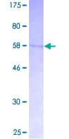 Human CDK5R1 Protein (Recombinant GST)