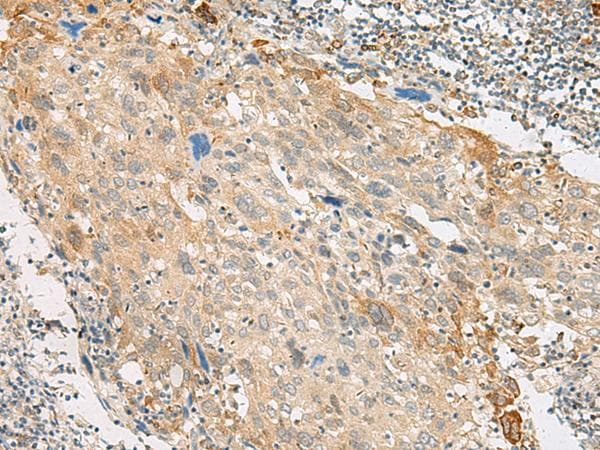 GPR151 Antibody