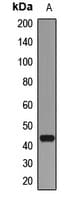 HERPUD1 / HERP Antibody