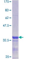 Human CBS Protein (Recombinant GST, N-terminus)