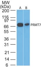 IHC-plus™ Polyclonal Rabbit anti-Human PRMT7 Antibody (aa346-360, IHC, WB)