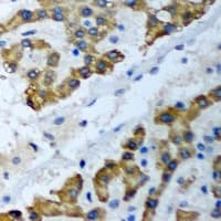 PSMF1 Antibody