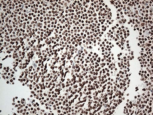 EWSR1 / EWS Antibody (aa256-447, clone OTI3F6, Carrier-free)