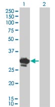 BDNF Antibody (clone 1B10)