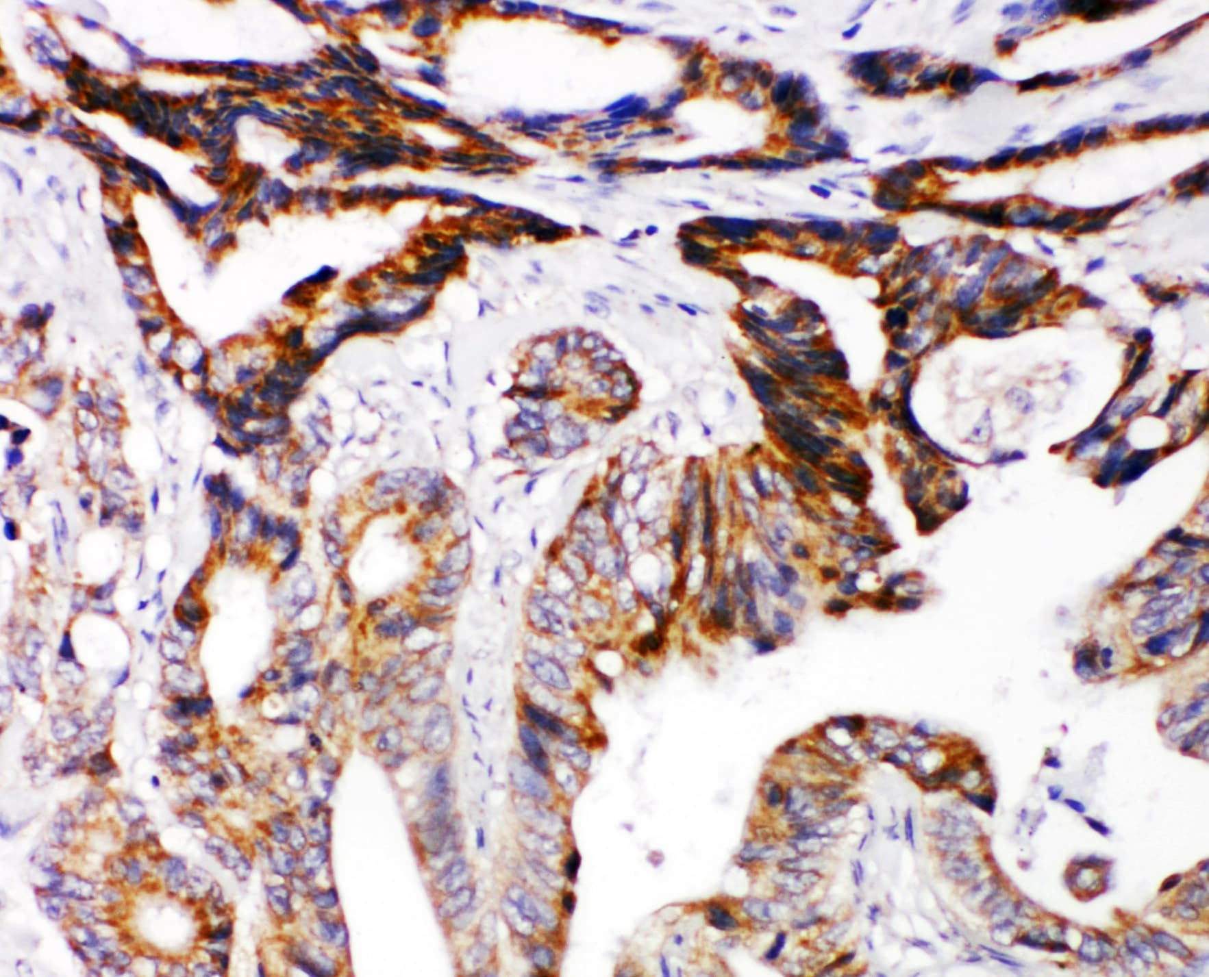 Polyclonal Rabbit anti-Human DCC Antibody (aa162-178, IHC, WB)