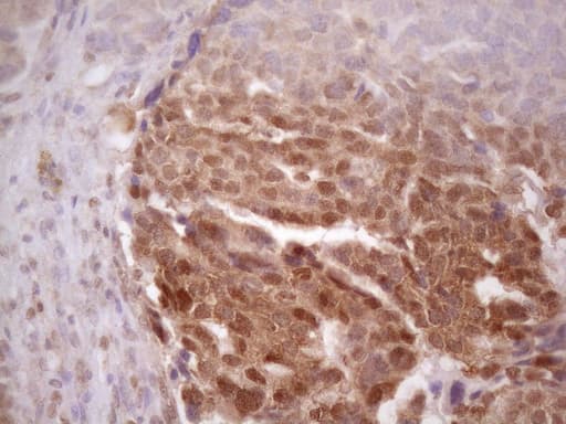 Monoclonal Mouse anti-Human PRPK / TP53RK Antibody (clone OTI5B2, Carrier-free, IHC, WB)