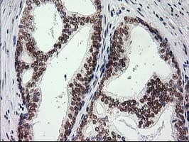 PRKCE / PKC-Epsilon Antibody (clone OTI4G8)