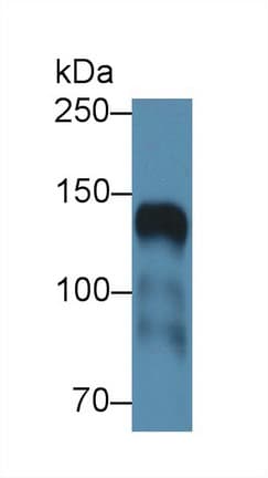 ICAM5 / ICAM-5 Antibody (aa409-674, PE)