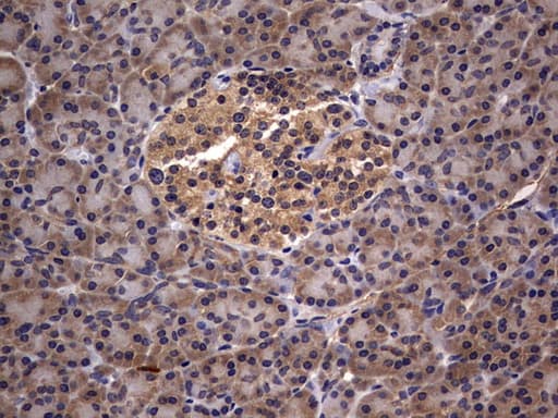 IL1RN Antibody (clone OTI3B1)