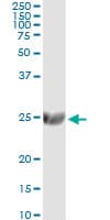ST6GAL1 / CD75 Antibody (clone 2E12)