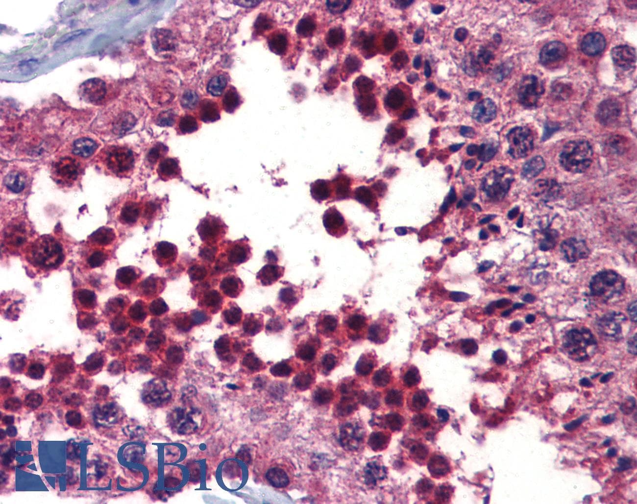 Polyclonal Rabbit anti-Human BMPER Antibody (aa501-550, IHC, WB)