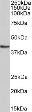 IHC-plus™ HMBS / PBGD Antibody