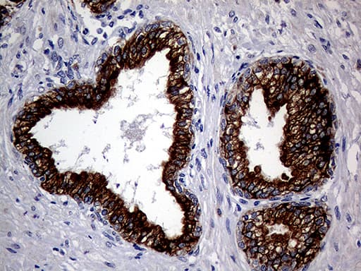 KRT8 / CK8 / Cytokeratin 8 Antibody (aa91-381, clone OTI2F5)