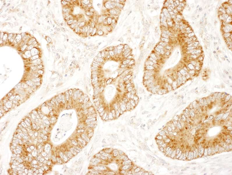 DENN / MADD Antibody (aa1597-1647)