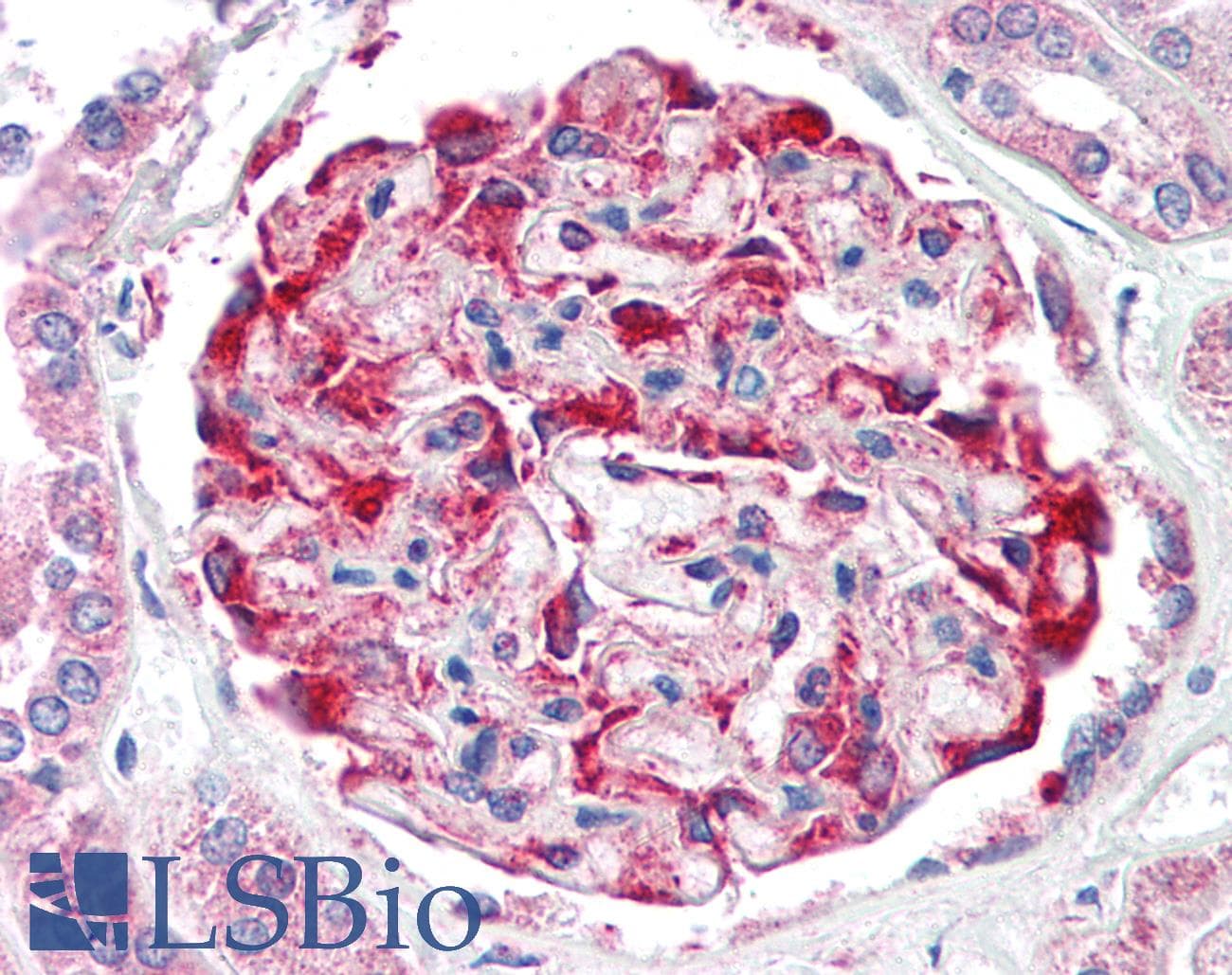 IHC-plus™ Polyclonal Rabbit anti-Human CDH11 / Cadherin 11 Antibody (Intracellular, IHC, WB)