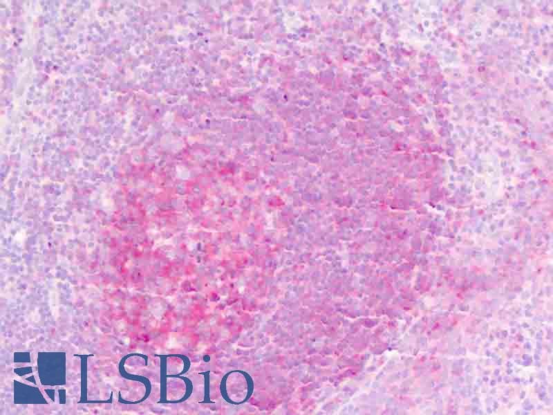 IHC-plus™ Polyclonal Rabbit anti-Human IL1RL2 Antibody (aa257-286, IHC, WB)