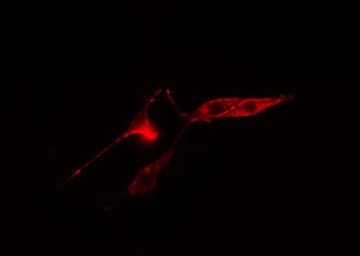 RPS12 / Ribosomal Protein S12 Antibody
