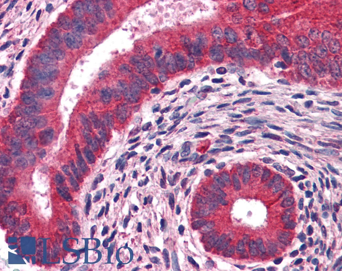 IHC-plus™ Monoclonal Mouse anti-Human EGF Antibody (clone 9D7F11, IHC, WB)