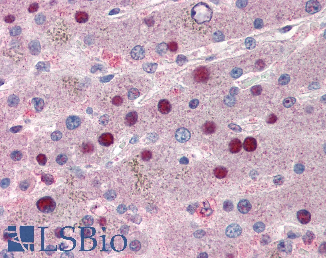 IHC-plus™ NACA Antibody (C-Terminus)