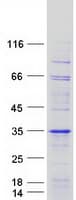 Human ODF3 Protein (Recombinant Myc-DDK (Flag))