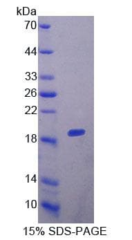 Human COL6A1 / Collagen VI Alpha 1 Protein (Recombinant His)
