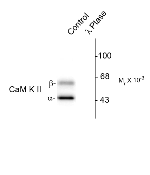IHC-plus™ CAMK2 / CAMKII Antibody (phospho-Thr286)