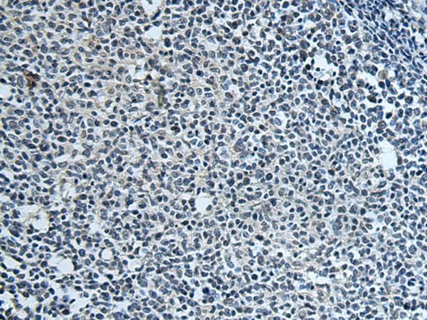 FCRLA Antibody
