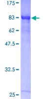 Human RUNX1T1 / ETO Protein (Recombinant GST)