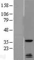 QKI Protein (Over-Expression Lysate Myc-DDK (Flag))