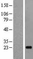 IL19 Protein (Over-Expression Lysate Myc-DDK (Flag))