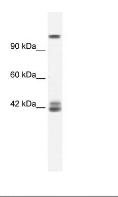 GRIN2C / NMDAR2C / NR2C Antibody (aa69-118)