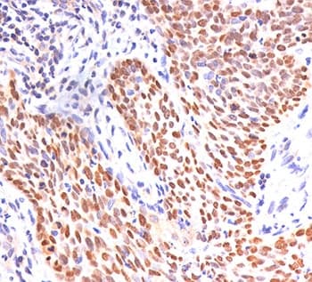 TP63 / p63 Antibody (aa5-17)