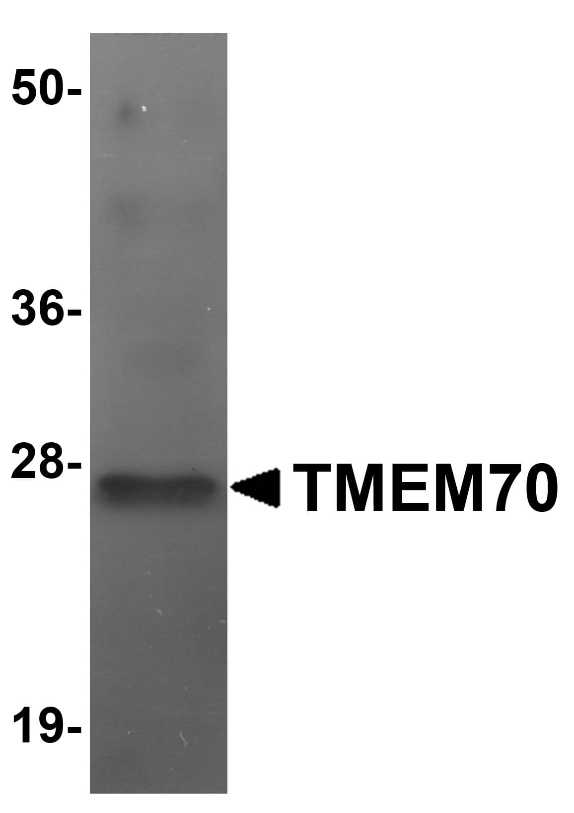 IHC-plus™ TMEM70 Antibody