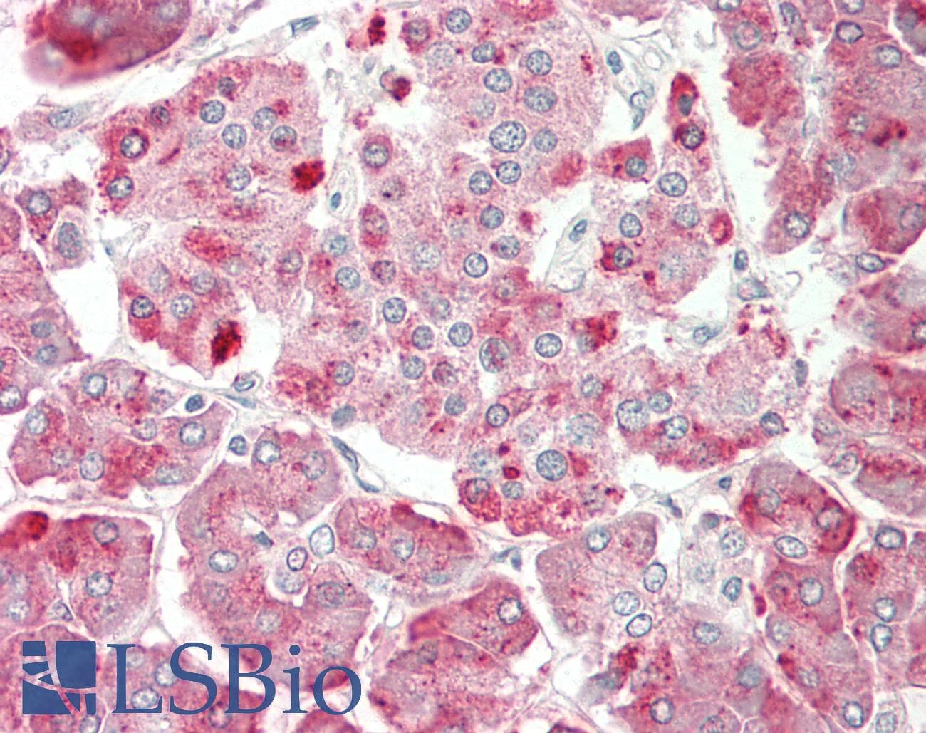 Polyclonal Rabbit anti-Human KIAA1324 / maba1 Antibody (aa110-159, IHC, WB)