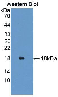 GLDC Antibody (aa81-268)