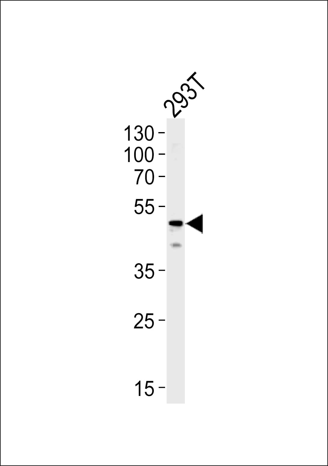 YBX1 / YB1 Antibody (aa149-178)