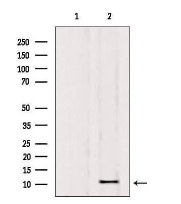 Osteocalcin Antibody