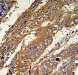 Polyclonal Rabbit anti-Human PAN3 Antibody (aa771-799, IHC, WB)