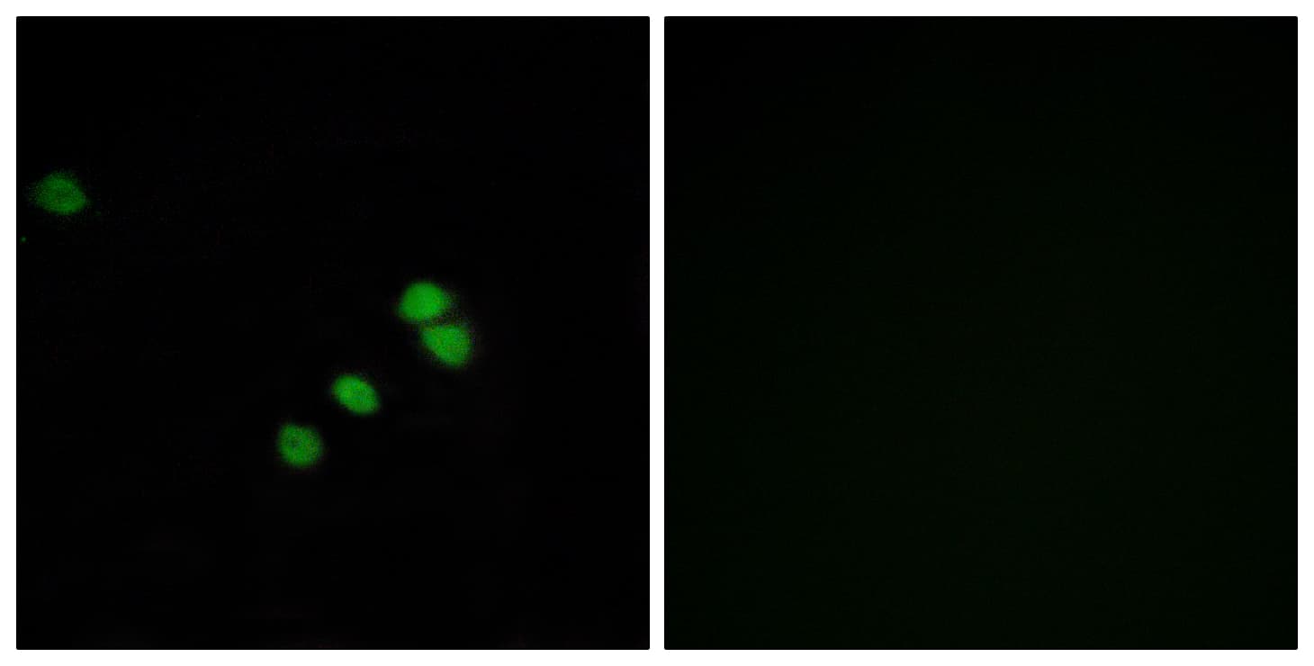 SP1 Antibody (aa706-755)