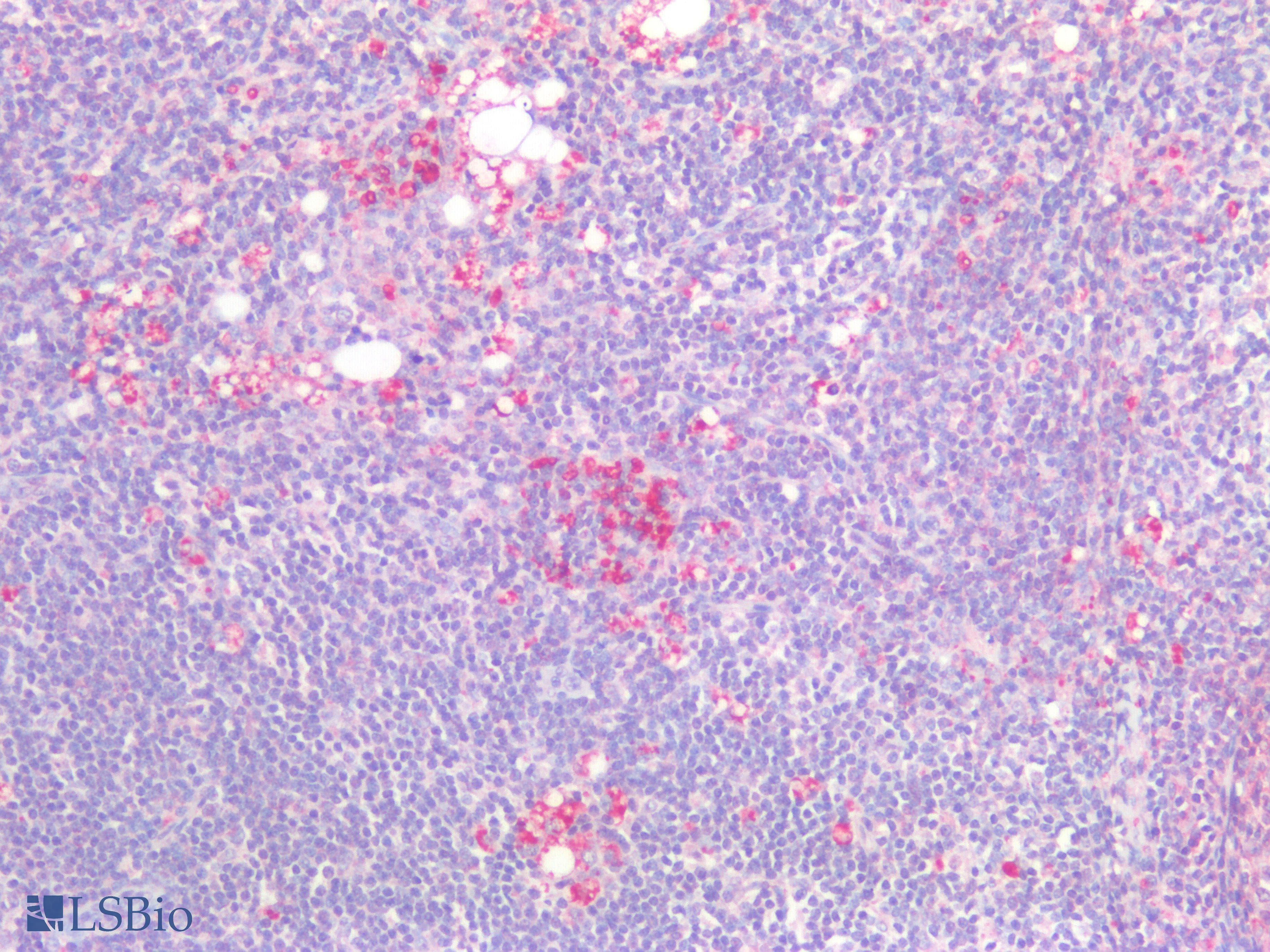 IHC-plus™ PD-L2 / PDCD1LG2 / CD273 Antibody