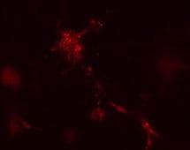 Polyclonal Rabbit anti-Human APG12 / ATG12 Antibody (aa8-38, IF, WB)
