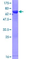 Human GALM / Mutarotase Protein (Recombinant GST)