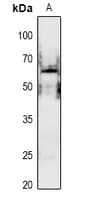 PAK1 Antibody