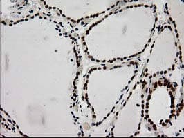 LOX / Lysyl Oxidase Antibody (clone OTI9G2)